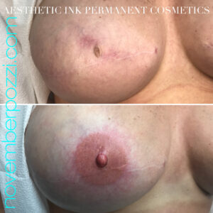3D Areola Restoration Tattooing - Aesthetic Ink Permanent Cosmetics